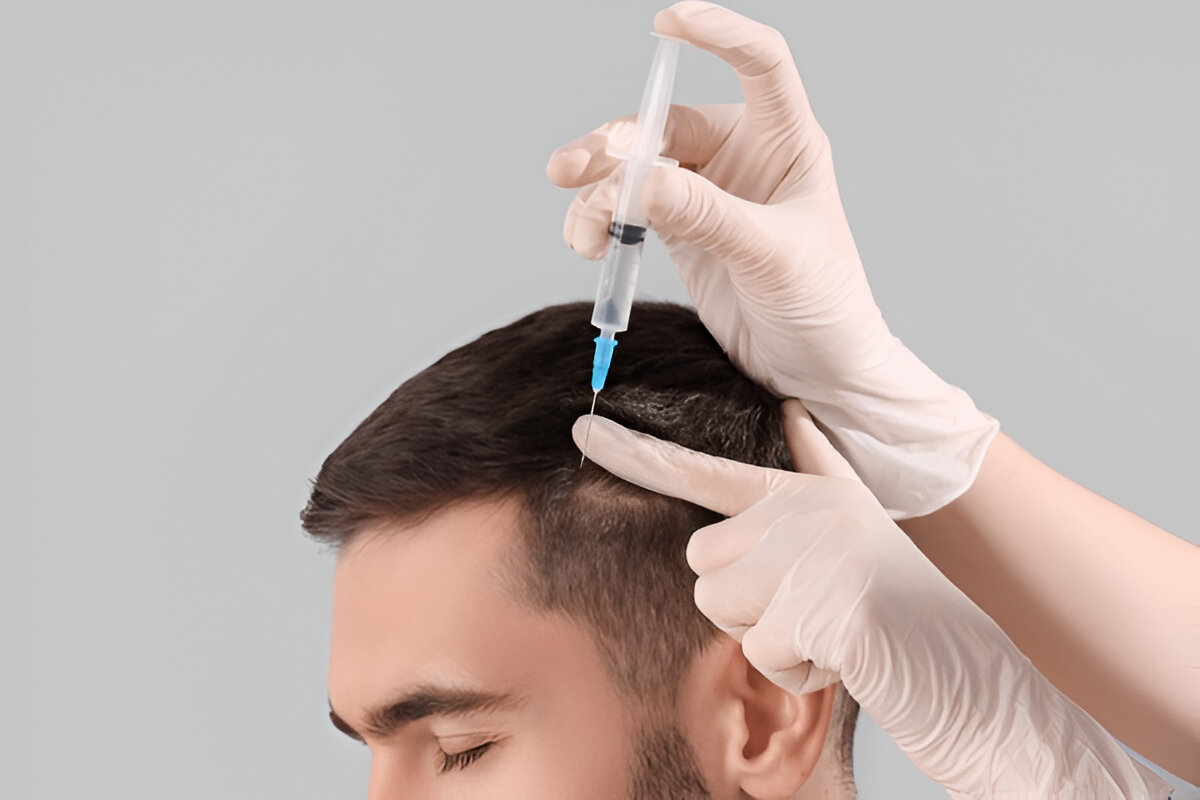 Hair Transplant