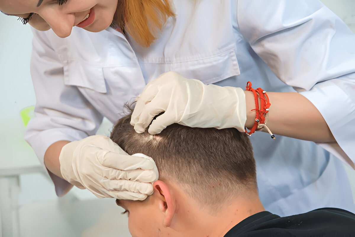 Hair Transplant