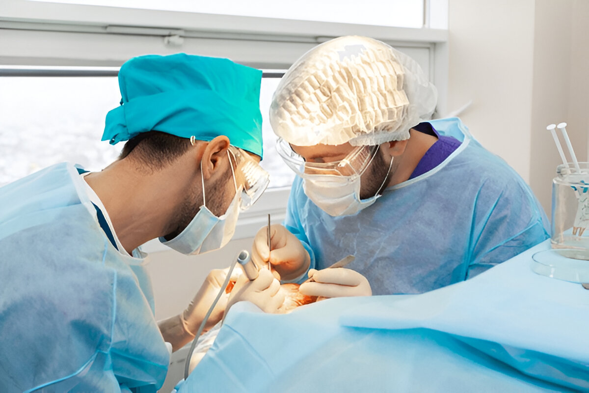 Hair Transplant Success Stories in London