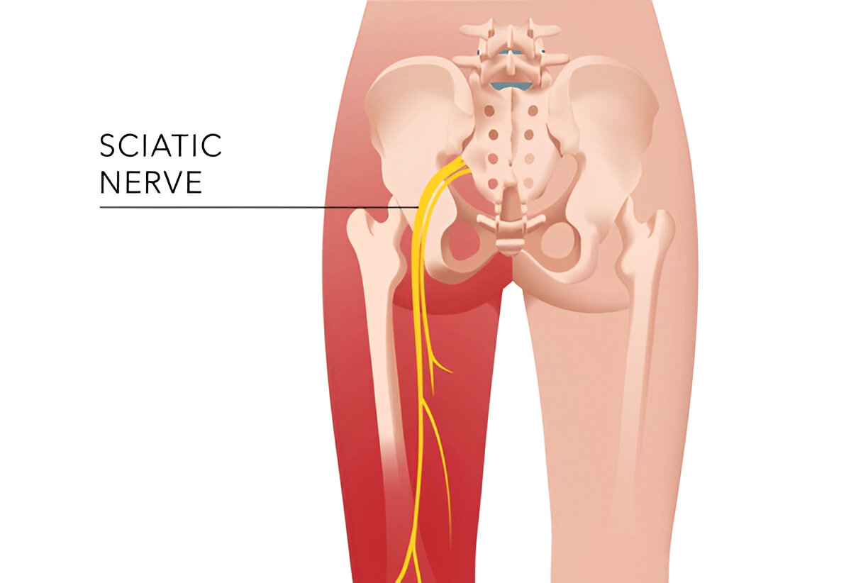 The Power of Heat in Back Pain Management: Discover Thermobalancing Therapy